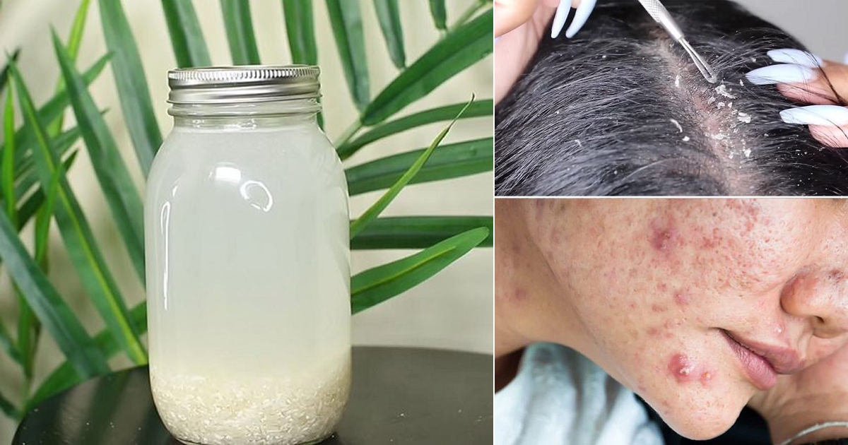 Is Rice Water Supposed to Smell Bad?