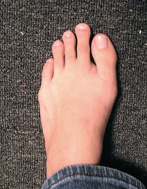 Celtic Feet