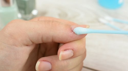 How to Whiten Nails With Vinegar 3