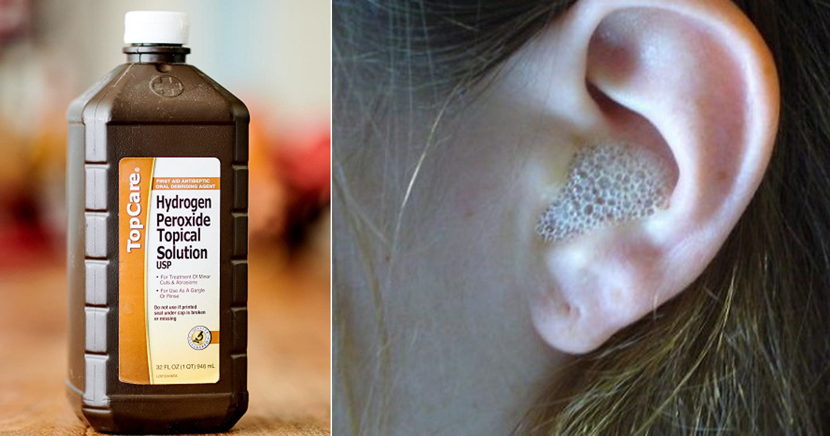 Hydrogen Peroxide For Clogged Ear Clogged Ear Remedies Hello Lidy Hydrogen Peroxide For Clogged Ear Clogged Ear Remedies Hello Lidy