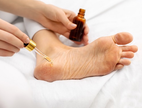 Essential Oils for Foot Fungus 2