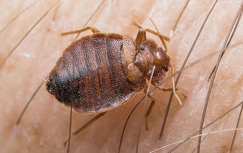 Can Bed Bugs Live In Your Hair 1